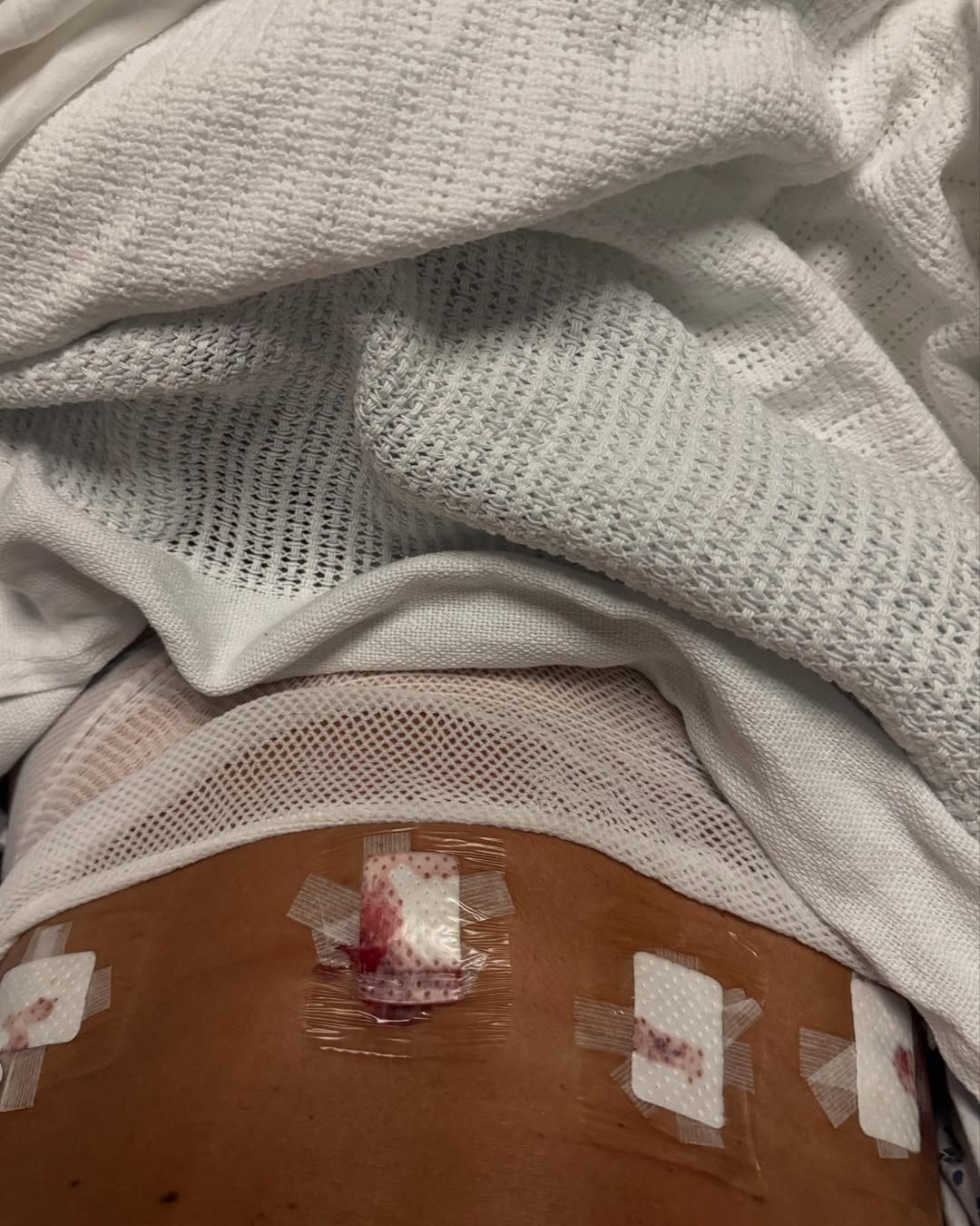 Sky Sports Presenter Anna Woolhouse Reveals Endometriosis Surgery