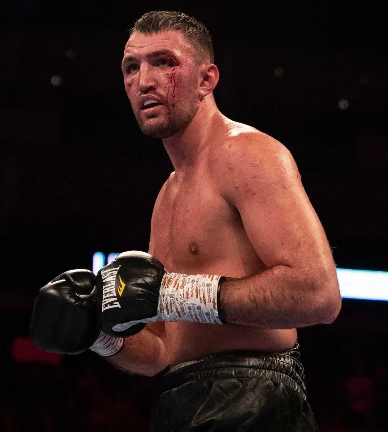 Dillian Whyte 'Frontrunner' to Fight Hughie Fury in 26,000-Capacity Stadium in Ireland