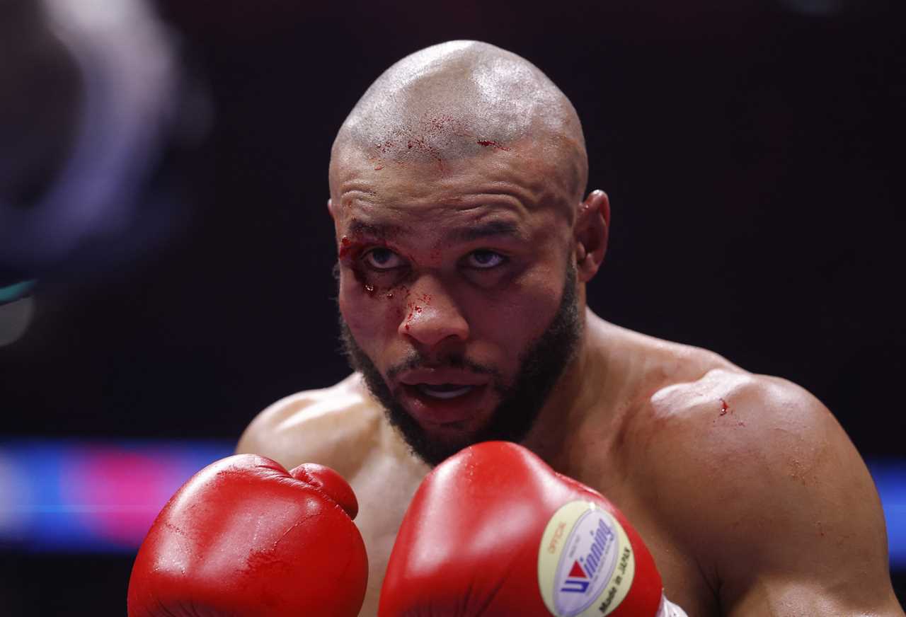 EXCLUSIVE: Chris Eubank Jr's Near-Death Hospital Drama After Conor Benn Bout!