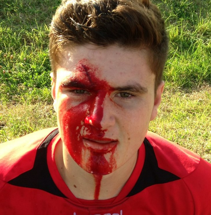 EXCLUSIVE: Johnny Fisher's Eerie Blood Drama in the Ring... but Rugby Days Reveal Even Darker Secrets!
